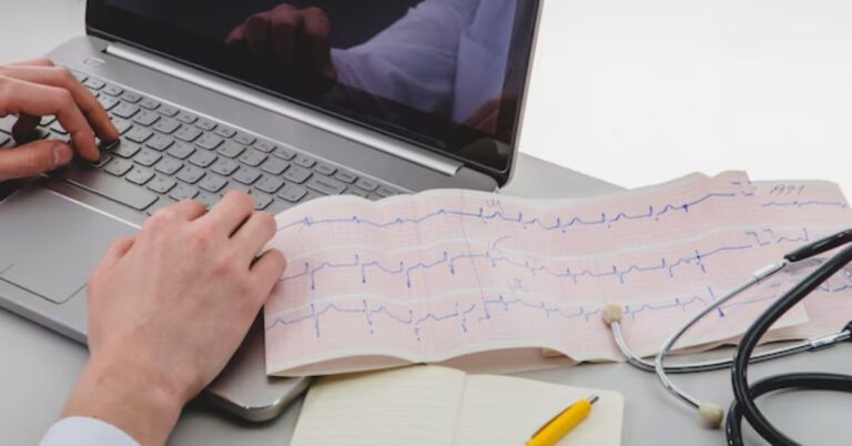 practice ekg strips with answers pdf